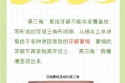 黑三角斑块的魅力,蓝三角的寿命与习性