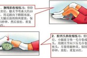 髌骨外翻正确的锻炼方法(髌骨外翻如何复位)