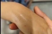 被猫抓伤10日观察法,小猫几个月打疫苗多少钱