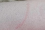 兔子狂犬病知识普及(兔子抓伤咬伤后是否需要接种狂犬疫苗)