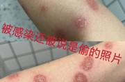 猫瘟的典型症状,猫瘟的五个常见症状