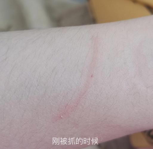 兔子狂犬病知识普及(兔子抓伤咬伤后是否需要接种狂犬疫苗)