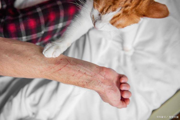 猫抓热(猫抓热揭秘猫咪抓挠后的细菌传输)