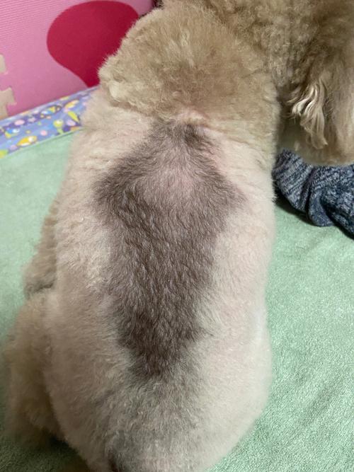 库欣病属于重大疾病吗(库欣病最佳治疗方法)