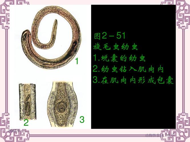 旋毛虫病(旋毛虫成虫寄生部位)