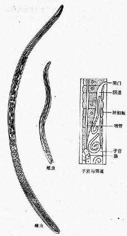 旋毛虫病(旋毛虫成虫寄生部位)
