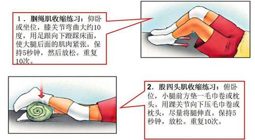 髌骨外翻正确的锻炼方法(髌骨外翻如何复位)