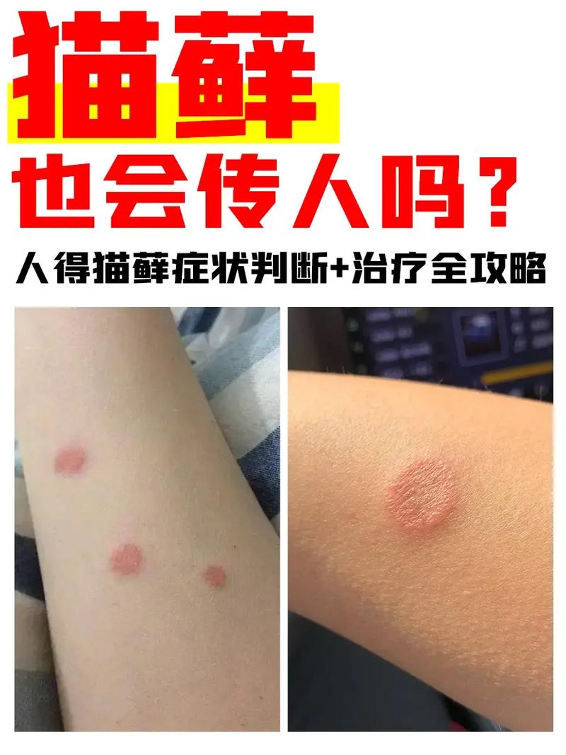 猫癣长什么样子图片 传染,猫癣长什么样子怎么判断