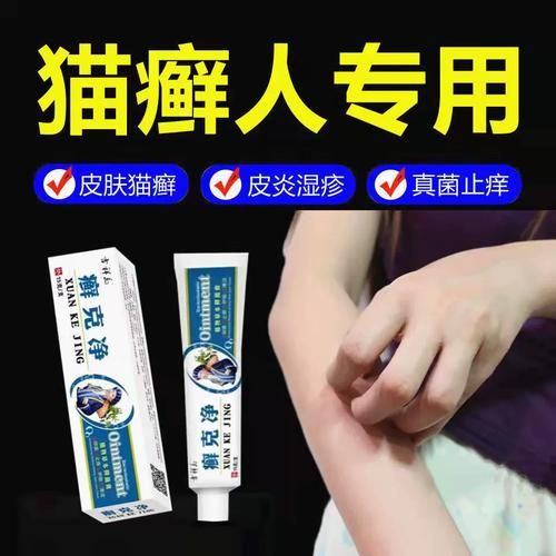 治猫藓最有效药膏人,治猫藓最有效药膏有哪些