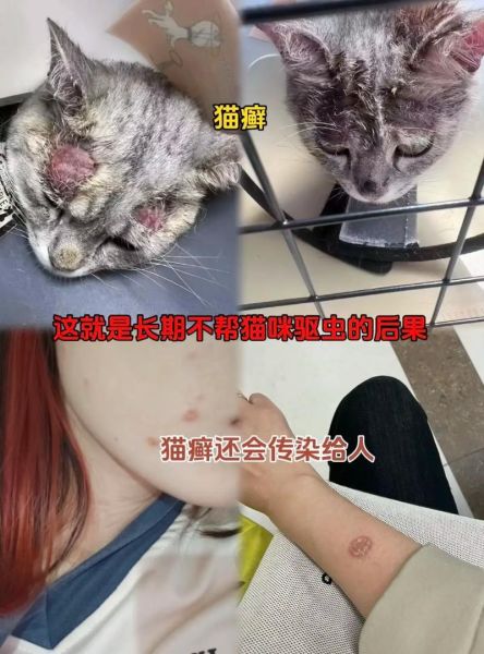 猫身上有蜱虫怎么办,猫身上有蜱虫吗传染人的症状
