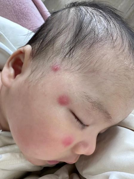 蚊子咬狗狗吗会痒吗,蚊子会咬狗狗吗图片