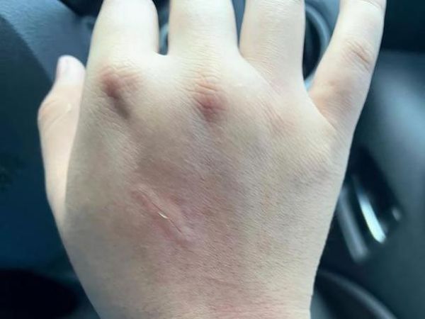 被猫抓伤10日观察法,小猫几个月打疫苗多少钱